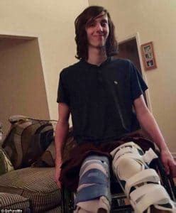 jacob ohl|Teen sues after losing legs in train accident